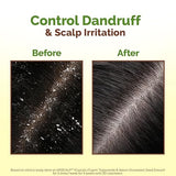 Mamaearth Lemon Anti-Dandruff Hair Oil